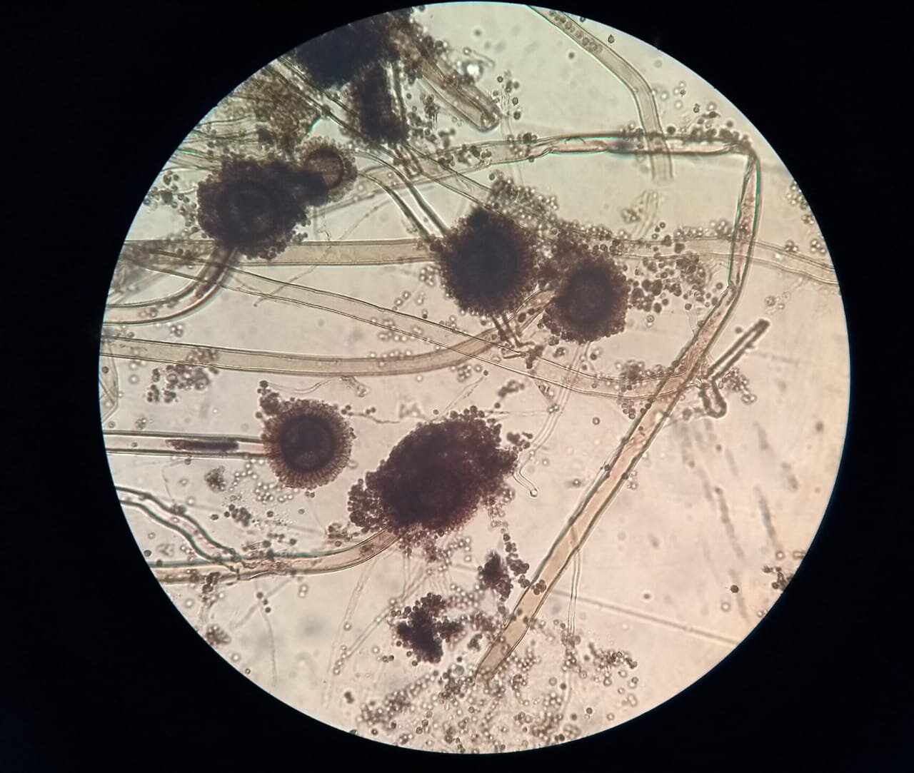 Aspergillus spp
