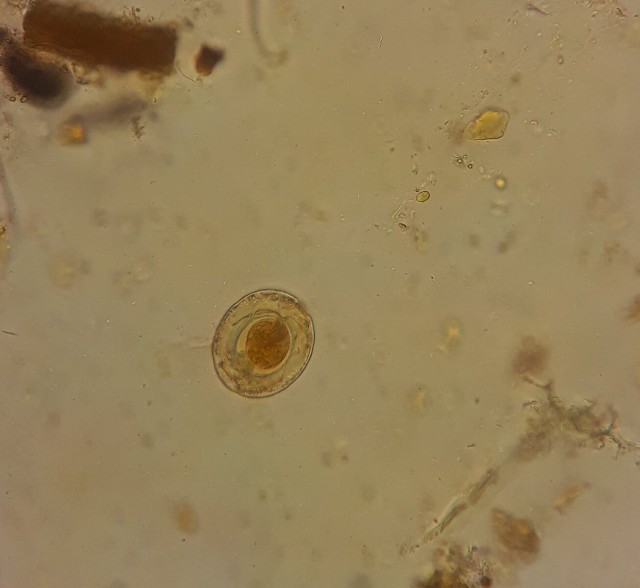 Atlas de Parasitologia