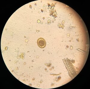 Ascaris lumbricoides decorticado
