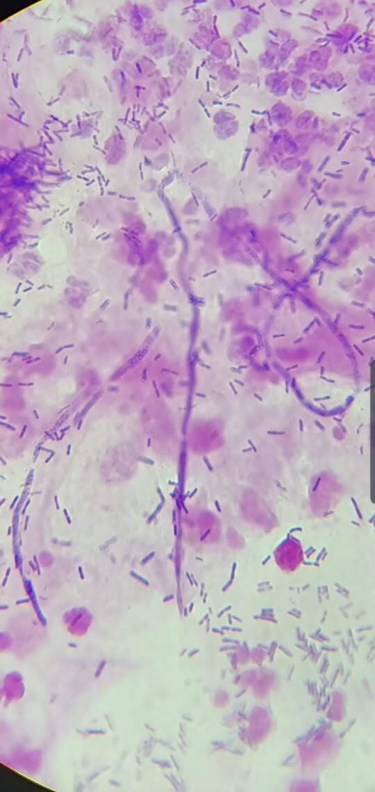 Candida spp