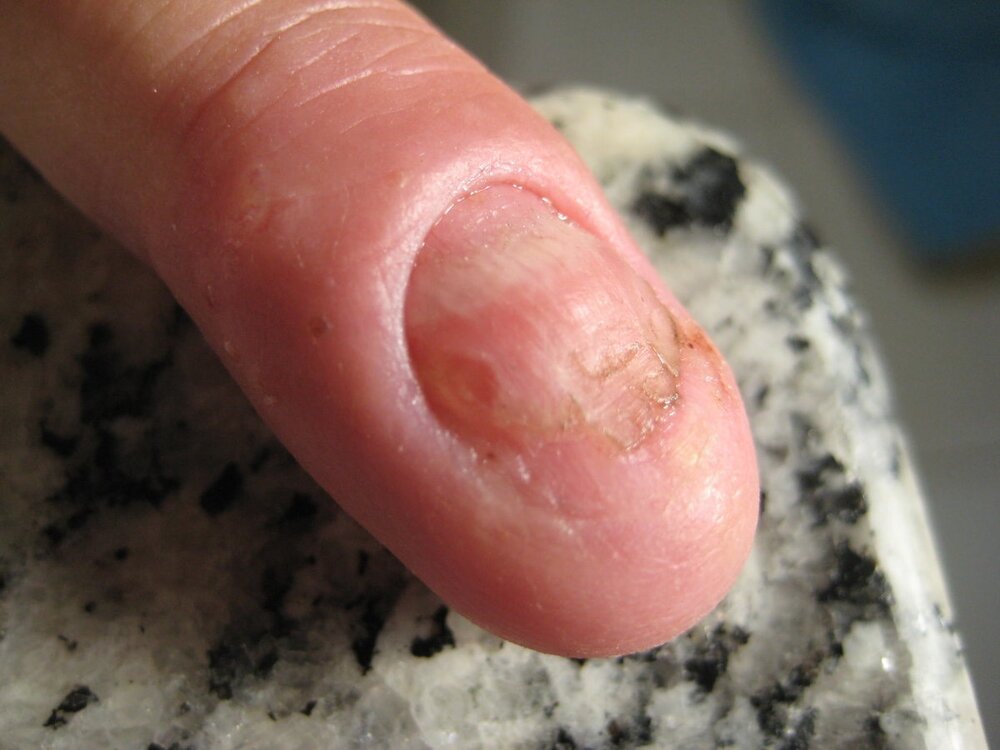 1.thumb.jpg.a86aba6d4d62e510b02aedd9a9678fbf.jpg