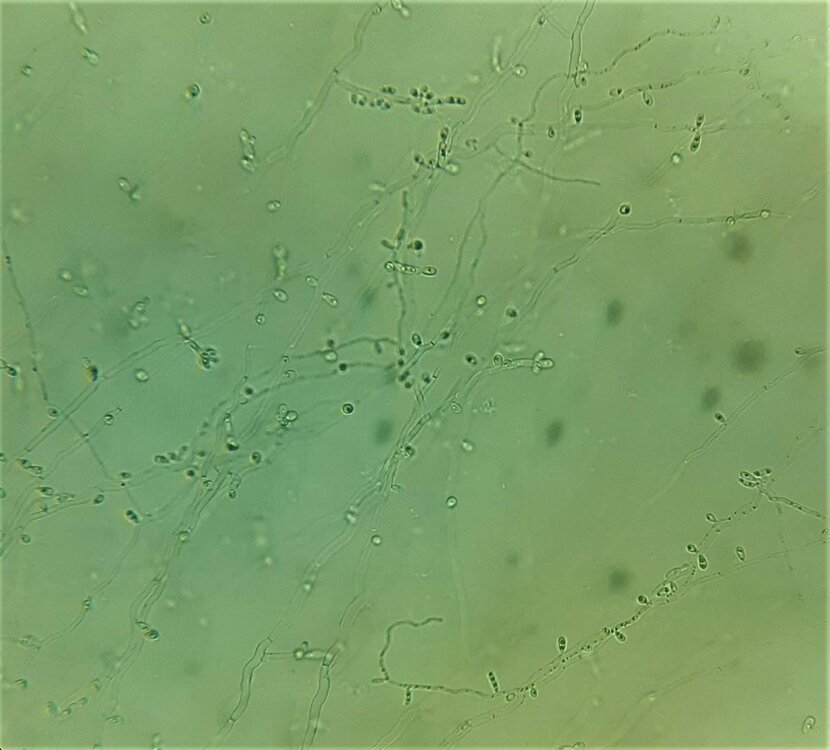 22.thumb.jpg.af61af25a937900c2eff1d928cd1cca9.jpg