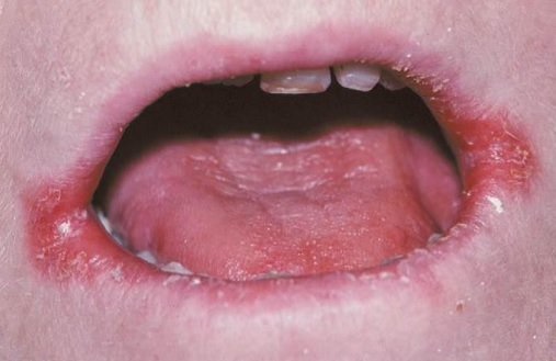 3.jpg.a51900e9844c28b05e9202dd820a1afd.jpg